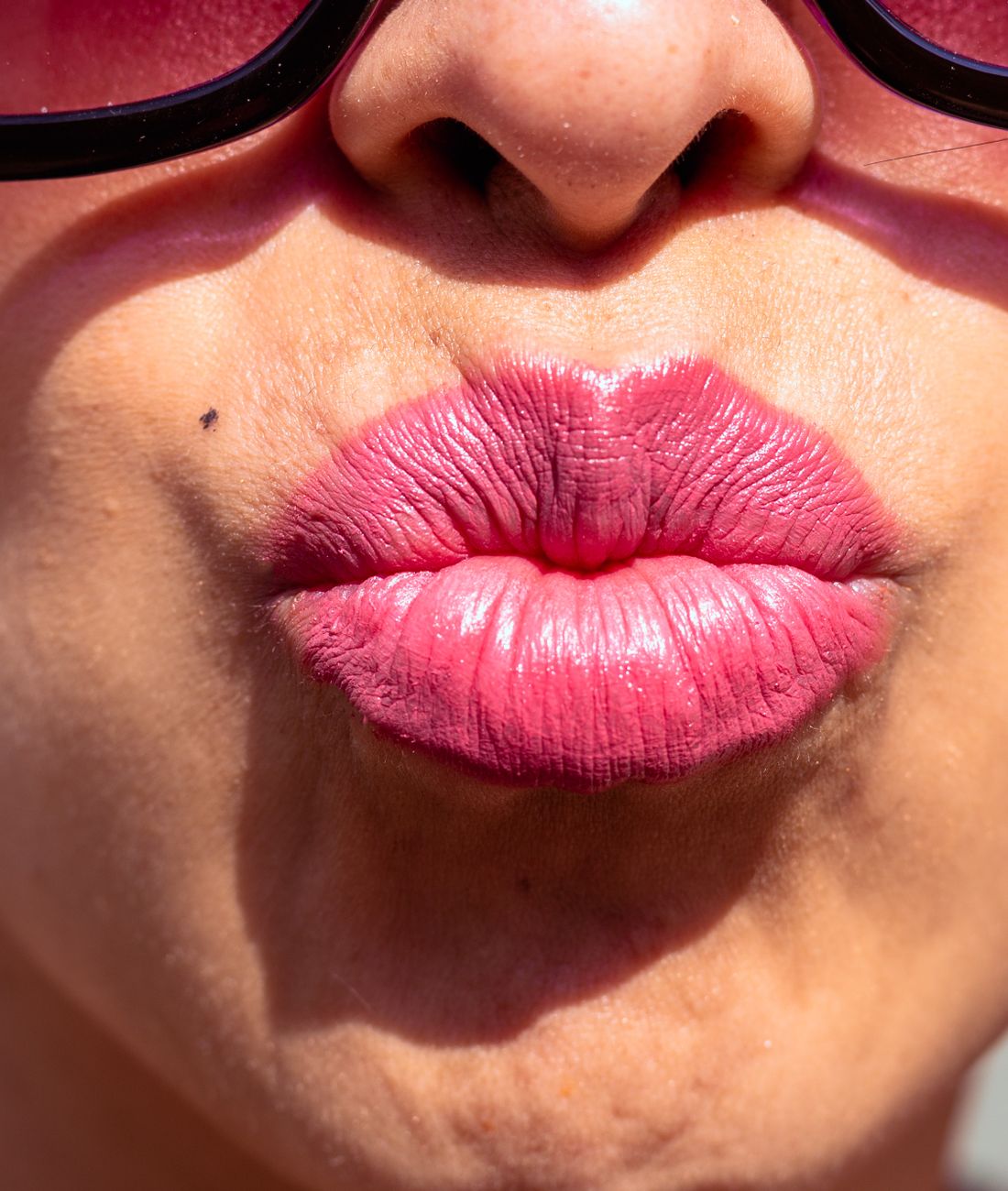 Aumento de labios